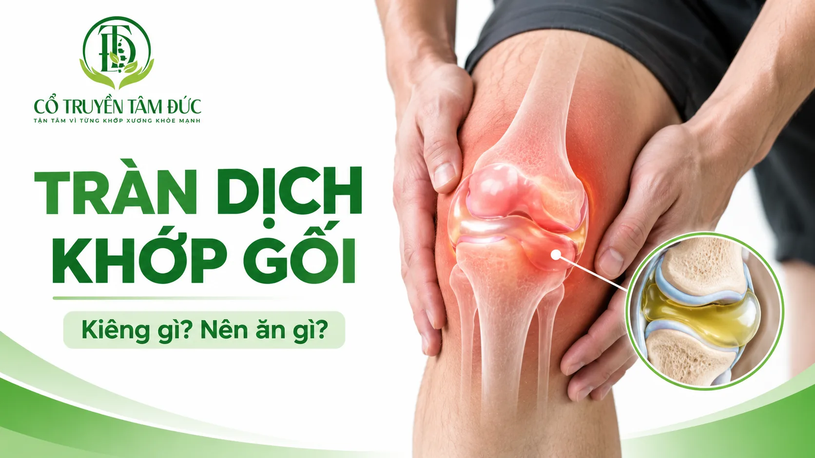 Bị tràn dịch khớp gối kiêng ăn gì? Nên ăn gì để hỗ trợ phục hồi?